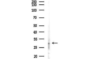 anti-Cyclin D2 (CCND2) (pThr280) antibody