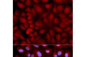 Immunofluorescence analysis of U2OS cells using SNCG Polyclonal Antibody (SNCG Antikörper)