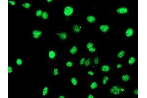 Anti-SERPINB6 mouse monoclonal antibody (ABIN2455600) immunofluorescent staining of COS7 cells transiently transfected by pCMV6-ENTRY SERPINB6 (RC200668). (SERPINB6 Antikörper)