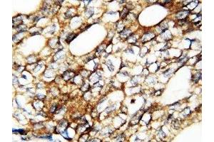 Immunohistochemistry (IHC) image for anti-Fibroblast Growth Factor 1 (Acidic) (FGF1) (AA 16-155) antibody (ABIN3030929)