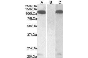 Western Blotting (WB) image for anti-Furin (Paired Basic Amino Acid Cleaving Enzyme) (FURIN) (C-Term) antibody (ABIN2473713) (FURIN Antikörper  (C-Term))