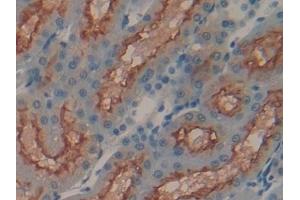 Detection of MEP1a in Human Kidney Tissue using Polyclonal Antibody to Meprin A Alpha (MEP1a) (MEP1A Antikörper  (AA 213-506))