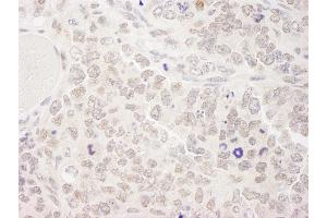 Immunohistochemistry (IHC) image for anti-Superkiller Viralicidic Activity 2-Like 2 (SKIV2L2) (AA 100-150) antibody (ABIN7448797) (MTR4 Antikörper  (AA 100-150))
