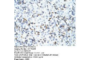Rabbit Anti-CPSF3 Antibody  Paraffin Embedded Tissue: Human Liver Cellular Data: Liver cells Antibody Concentration: 4. (CPSF3 Antikörper  (C-Term))