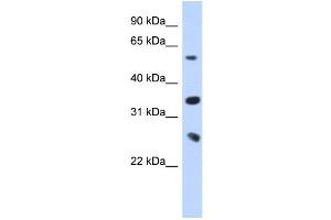 WB Suggested Anti-UBE2K Antibody Titration:  0. (UBE2K Antikörper  (Middle Region))