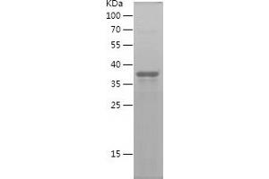 SFRP2 Protein (AA 25-171) (His-IF2DI Tag)