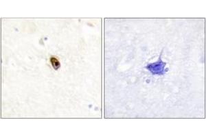 Immunohistochemistry analysis of paraffin-embedded human brain, using AurB/C (Phospho-Thr236/202) Antibody. (AurB/C Antikörper  (pThr236))