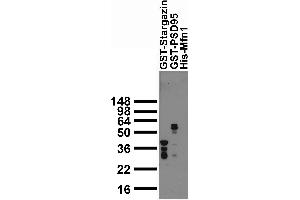 Bacterially expressed GST fusion protein immunoblot.