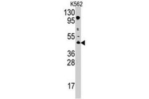 Western blot analysis of PRMT8 polyclonal antibody  in K-562 cell line lysates (35 ug/lane). (PRMT8 Antikörper  (C-Term))