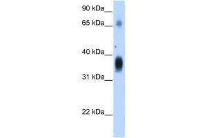 NOV antibody used at 1. (NOV Antikörper  (Middle Region))