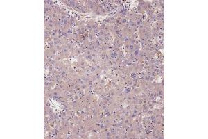 Immunohistochemistry (Paraffin-embedded Sections) (IHC (p)) image for anti-Protein Kinase, CGMP-Dependent, Type I (PRKG1) (AA 629-660), (C-Term) antibody (ABIN392536)