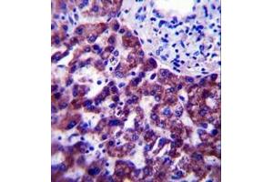 Immunohistochemistry analysis in formalin fixed and paraffin embedded human liver tissue reacted with OR14J1 Antibody (C-term) followed which was peroxidase conjugated to the secondary antibody and followed by DAB staining.