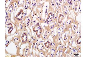 Formalin-fixed and paraffin embedded human kidney labeled with Rabbit Anti Phospho-Beta Catenin (Thr41/Ser45) Polyclonal Antibody, Unconjugated (ABIN683953) at 1:200 followed by conjugation to the secondary antibody and DAB staining (beta Catenin Antikörper  (pSer45, pThr41))