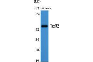 Western Blot (WB) analysis of specific cells using TrxR2 Polyclonal Antibody. (TXNRD2 Antikörper  (C-Term))