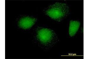 Immunofluorescence (IF) image for anti-Huntingtin Interacting Protein 1 Related (HIP1R) (AA 1-1068) antibody (ABIN522471)