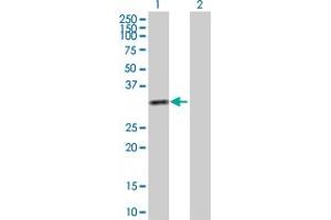 Western Blot analysis of KHK expression in transfected 293T cell line by KHK MaxPab polyclonal antibody. (Ketohexokinase Antikörper  (AA 1-298))