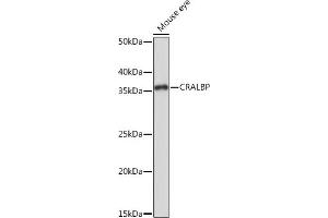 Western blot analysis of extracts of Mouse eye, using CRALBP Rabbit mAb (ABIN7269934) at 1:1000 dilution. (RLBP1 Antikörper)