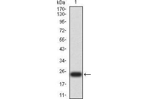 Western blot analysis using UCP3 mAb against human UCP3 (AA: 1-113 and 217-312) recombinant protein.