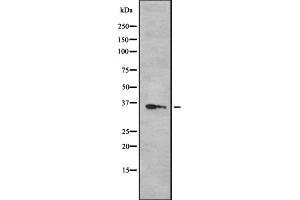 Western blot analysis OR52N5 using 293 whole cell lysates (OR52N5 Antikörper  (C-Term))