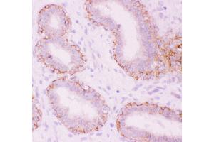 Anti-CTNNA1 Picoband antibody,  IHC(P): Human Mammary Tissue