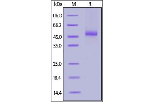 SDS-PAGE (SDS) image for Interleukin 13 Receptor, alpha 2 (IL13RA2) (AA 27-343) (Active) protein (FITC,His tag) (ABIN6950960)