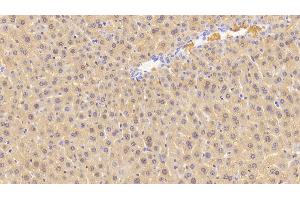 Detection of CGRP in Mouse Liver Tissue using Polyclonal Antibody to Calcitonin Gene Related Peptide (CGRP) (CGRP Antikörper  (AA 1-130))