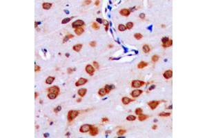 Immunohistochemical analysis of IPPK staining in human brain formalin fixed paraffin embedded tissue section. (IPPK Antikörper  (N-Term))