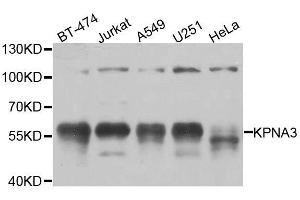 KPNA3 Antikörper  (AA 1-210)