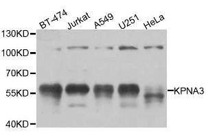 Western blot analysis of extracts of various cell lines, using KPNA3 antibody. (KPNA3 Antikörper  (AA 1-210))