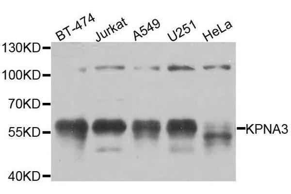 KPNA3 Antikörper  (AA 1-210)