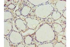 Immunohistochemistry of paraffin-embedded human thyroid tissue using ABIN7148776 at dilution of 1:100 (CMC4 Antikörper  (AA 1-68))
