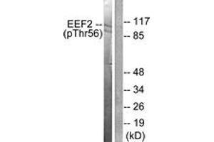 Western blot analysis of extracts from NIH-3T3 cells treated with Serum 10% 30', using eEF2 (Phospho-Thr56) Antibody. (EEF2 Antikörper  (pThr56))