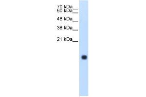 WB Suggested Anti-CST4 Antibody Titration:  1.