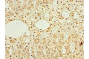 Immunohistochemistry of paraffin-embedded human adrenal gland tissue using ABIN7143883 at dilution of 1:100 (TFCP2 Antikörper  (AA 1-280))