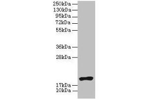 Western blot All lanes: NR2C2AP antibody at 4 μg/mL + HL60 whole cell lysate Secondary Goat polyclonal to rabbit IgG at 1/10000 dilution Predicted band size: 16, 20 kDa Observed band size: 20 kDa (NR2C2AP Antikörper  (AA 7-139))