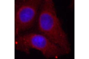 Immunofluorescence (IF) image for anti-Growth Associated Protein 43 (GAP43) (pSer41) antibody (ABIN1870201) (GAP43 Antikörper  (pSer41))