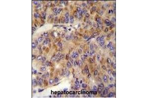 Immunohistochemistry (Paraffin-embedded Sections) (IHC (p)) image for anti-Multiple Inositol-Polyphosphate Phosphatase 1 (MINPP1) (AA 28-55), (N-Term) antibody (ABIN654085)