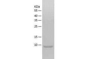 Chemokine (C-C Motif) Ligand 17 (CCL17) (AA 24-94) protein (His-IF2DI Tag)