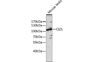 Western blot analysis of extracts of mouse testis, using CIZ1 antibody (ABIN7266237) at 1:1000 dilution.