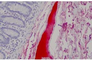 Human Blood Plasma: Formalin-Fixed, Paraffin-Embedded (FFPE) (Complement Factor H Antikörper)