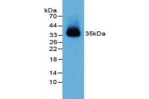 Western Blotting (WB) image for anti-Poliovirus Receptor-Related 2 (Herpesvirus Entry Mediator B) (PVRL2) (AA 83-291) antibody (ABIN7441877)