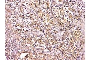 IHC analysis of CA2 using anti-CA2 antibody (ABIN6719533). (CA2 Antikörper  (AA 2-260))