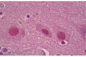 Anti-ROR Alpha antibody IHC staining of human brain, cortex. (RORA Antikörper  (AA 6-55))
