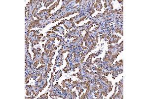 IHC analysis of TOMM34 using anti-TOMM34 antibody (ABIN7599253). (TOMM34 Antikörper  (AA 1-309))