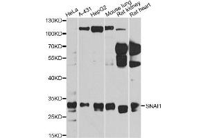 Western blot analysis of extracts of various cell lines, using SNAI1 antibody (ABIN5975364) at 1/1000 dilution.