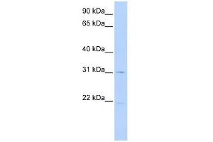 SLC25A21 antibody used at 1 ug/ml to detect target protein. (SLC25A21 Antikörper)