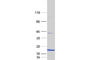 Western Blotting (WB) image for CD247 Molecule (CD247) (Transcript Variant 2) protein (Myc-DYKDDDDK Tag) (ABIN2713537)