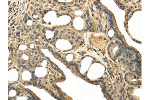 Immunohistochemistry (IHC) image for anti-Transient Receptor Potential Cation Channel, Subfamily C, Member 4 Associated Protein (TRPC4AP) antibody (ABIN5957757) (TRPC4AP Antikörper)