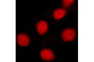ABIN6269055 staining MCF-7 cells by ICC/IF. (Survivin Antikörper  (Internal Region))