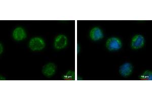 ICC/IF Image CHMP5 antibody [N1C3] detects CHMP5 protein at cytoplasm by immunofluorescent analysis.